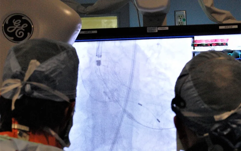 TAVI işlemi sırasında floroskopi görüntüsünü değerlendiren kalp ekibi