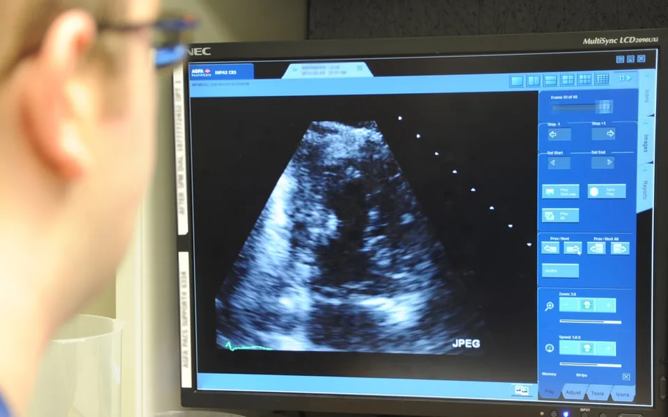 Ekokardiyografi ekranında mitral kapak değerlendirmesi